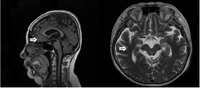 Рис 1 Быков.jpg