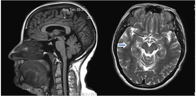 Рис 2 Быков.jpg