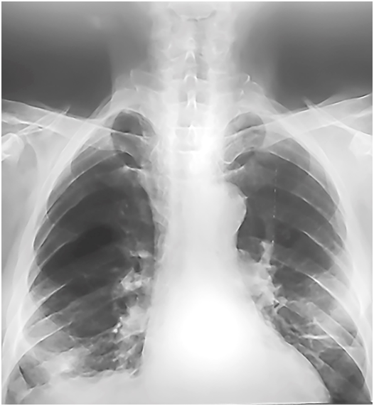 рис 8 Шевченко.png